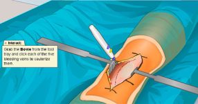 Virtual Knee Surgery [Unblocked] 66 EZ